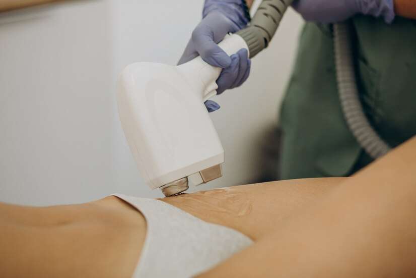 laser-epilation-hair-removal-therapy_1303-23658