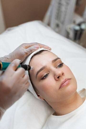 person-getting-micro-needling-beauty-treatment_23-2149334262