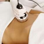 CoolSculpting