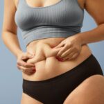 Inspiring Success Stories from CoolSculpting Patients