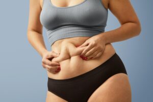 Inspiring Success Stories from CoolSculpting Patients