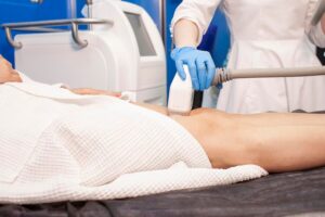 CoolSculpting Technology