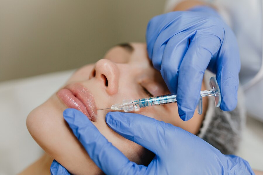 Juvederm Injections (1)