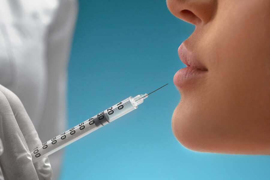 Juvederm Injections