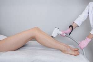 Common Misconceptions about Laser Hair Removal
