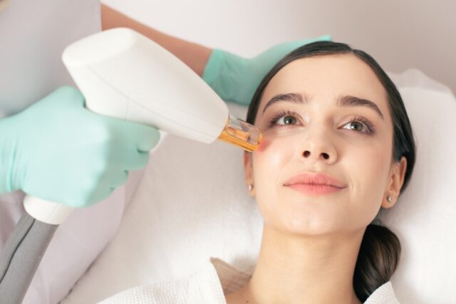 Microneedling to Smoother Skin