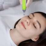 Microneedling Safety and Effectiveness