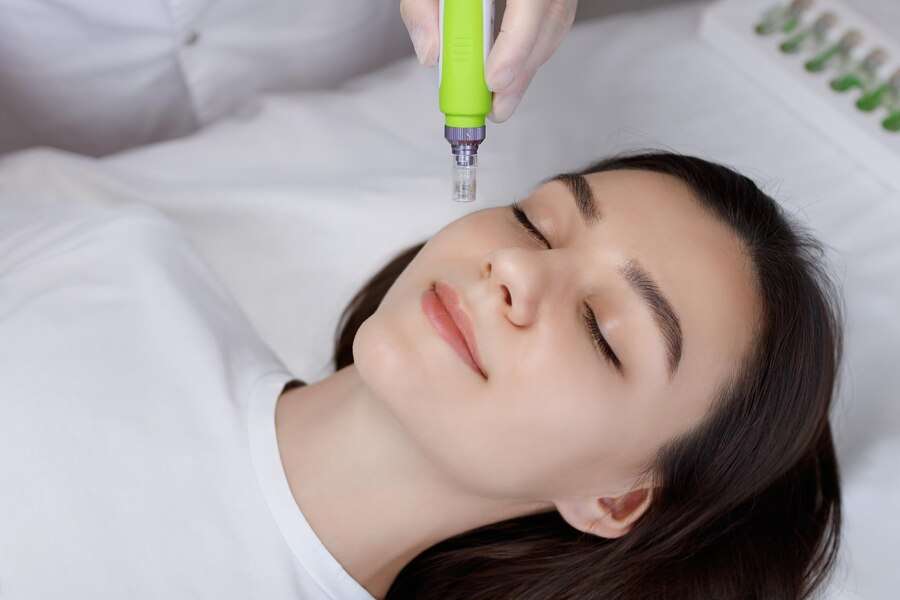 Microneedling Safety and Effectiveness