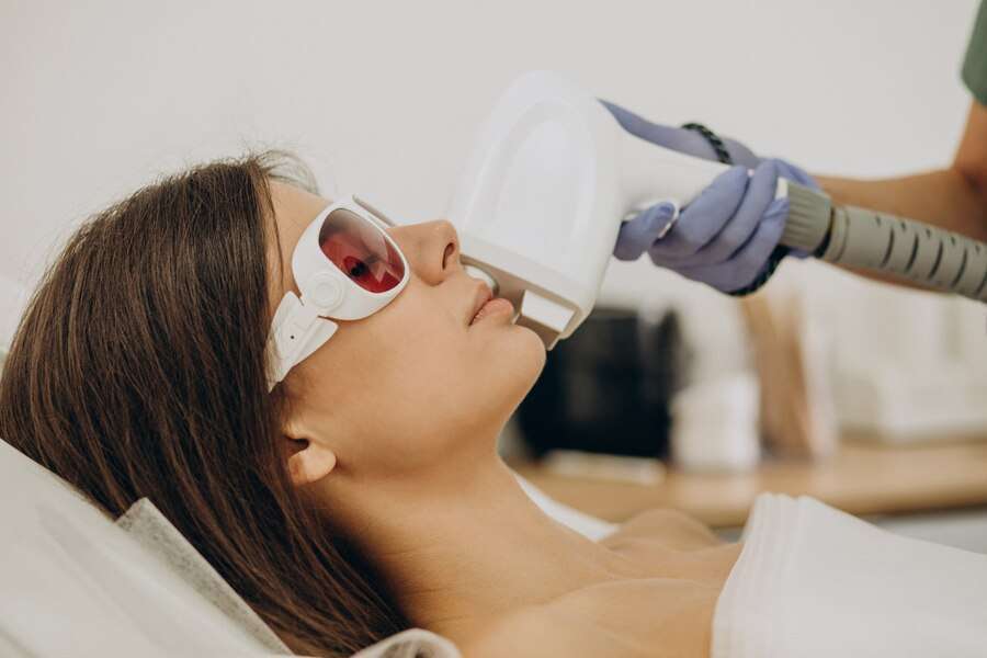 laser hair removal therapy