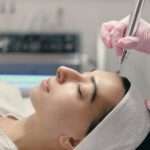 microneedling