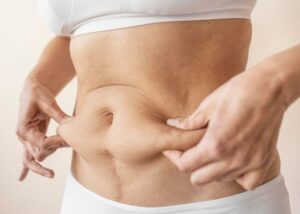Areas Treated by CoolSculpting