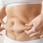 Areas Treated by CoolSculpting