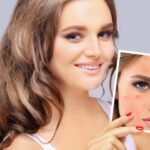 Microneedling Services