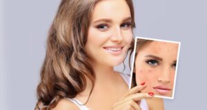 Cosmetic Procedure Examining Before and After Photos