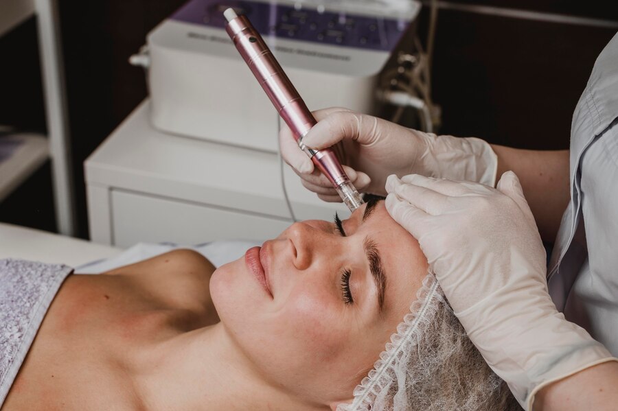 Microneedling Session