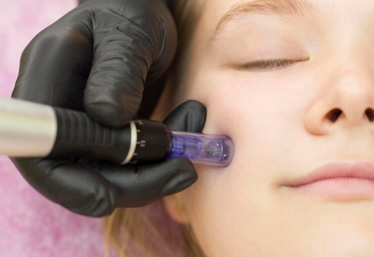 needle-mesotherapy-cosmetologist-performs-needle-mesotherapy-womans-face-beautiful-woman-receiving-microneedling-rejuvenation-treatment-needle-lifting_310443-518