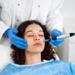 Microneedling for Scars