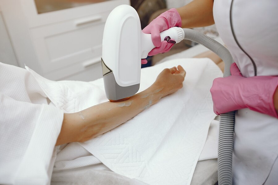 Full Body Laser Hair Removal