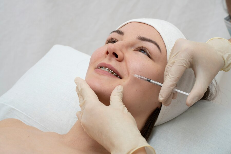 Acne Scar Microneedling