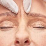 Glabella (Frown Lines) Botox