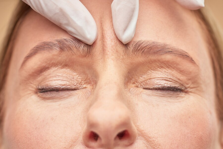 Glabella (Frown Lines) Botox