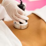 CoolSculpting Charges Lubbock