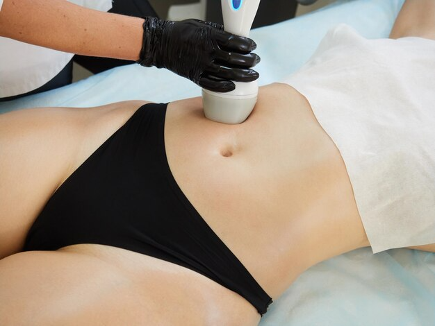 CoolSculpting Charges Midland