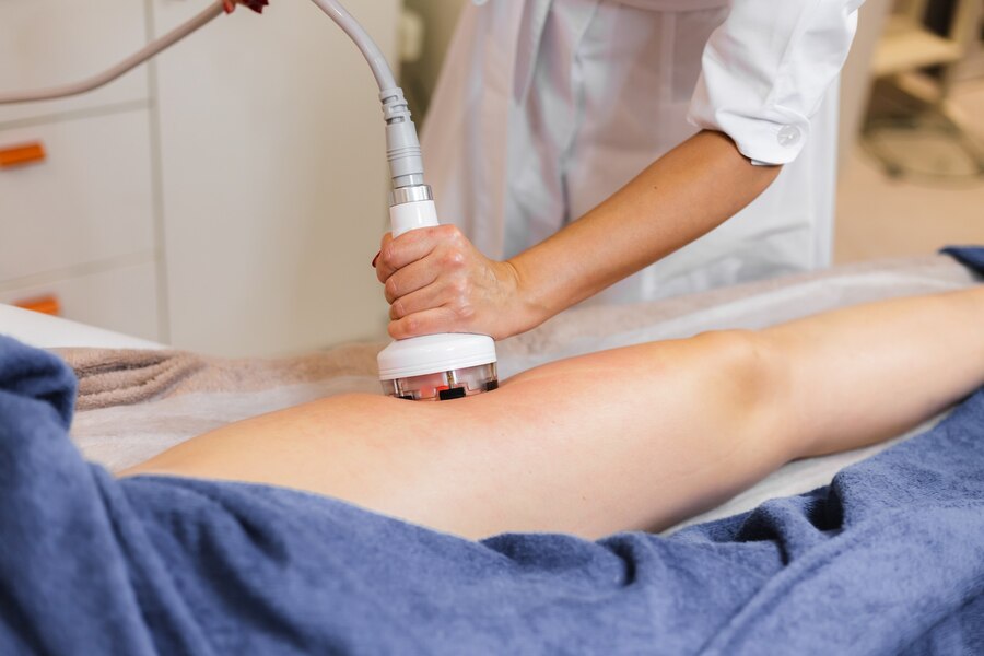 CoolSculpting cost