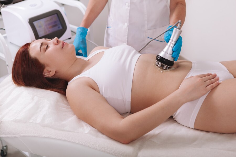 CoolSculpting