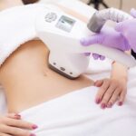 CoolSculpting Corpus Christi