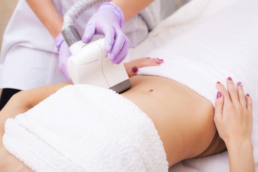 CoolSculpting