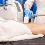 Coolsculpting Corpus Christi