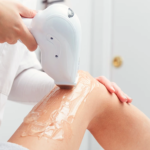 Hair Removal Corpus Christi