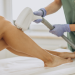 advanced-laser-hair-removal-corpus-christi-achieve-smooth-hair-free-skin